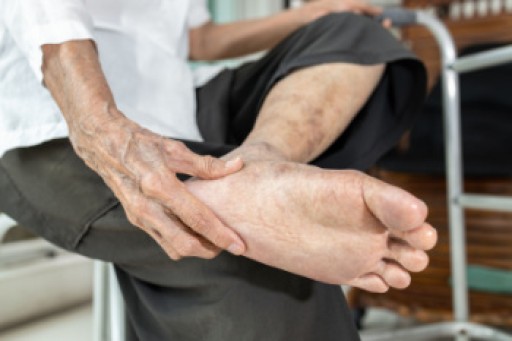 Treating Tarsal Tunnel Syndrome