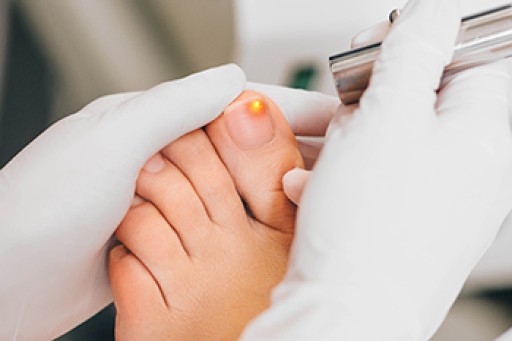 Methods of Treating Toenail Fungus