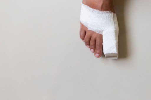 What to Know About a Broken Toe