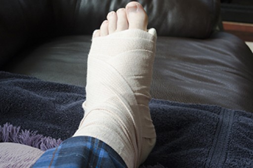 Causes, Symptoms, and Treatment for a Broken Foot