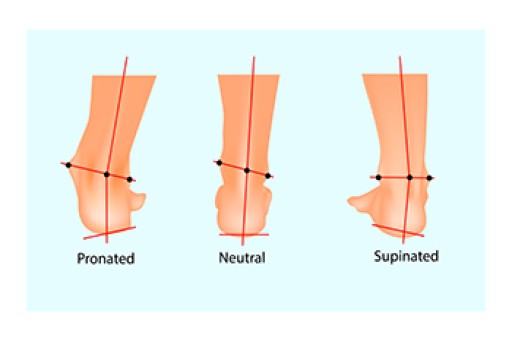 Effects of Foot Pronation