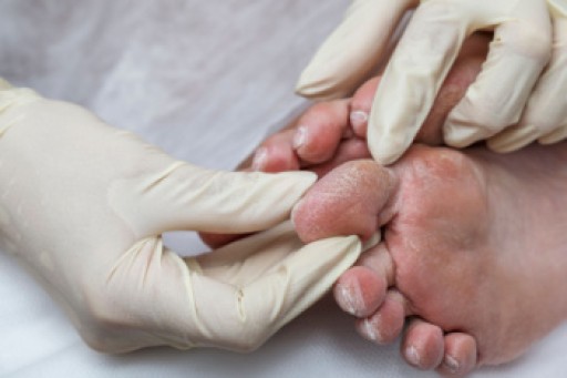Pressure Injuries and Diabetic Foot Wounds