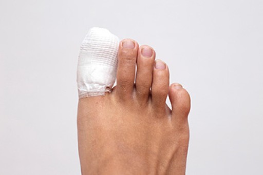 Broken Toes and Scooters
