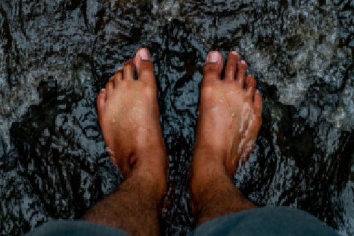 Surgical Treatment for Hammertoe